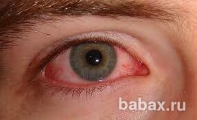 Как лечить глаза